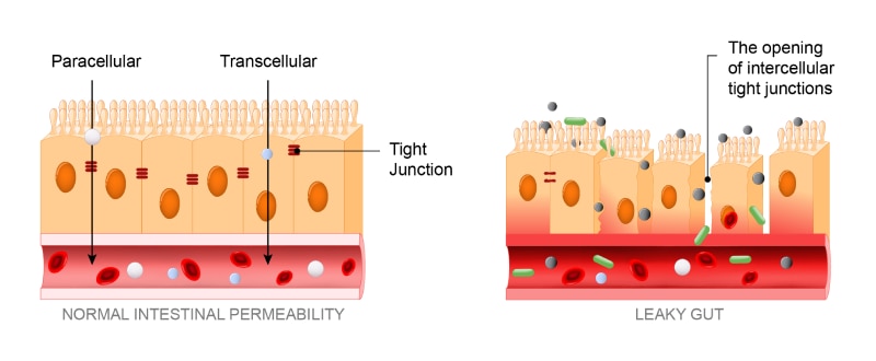 Diagram illustrating normal intestinal permeability vs. leaky gut